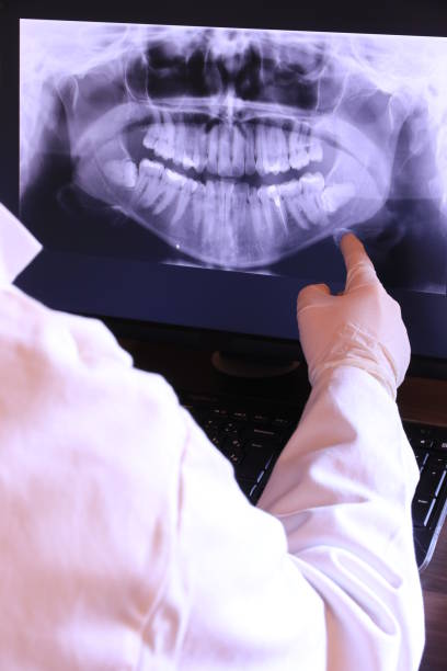 Best Emergency Wisdom Teeth Removal in Glendale, CA