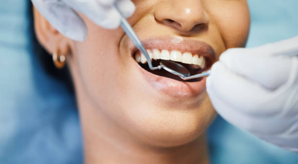 Best Emergency Dental Care for Broken or Chipped Teeth in Glendale, CA