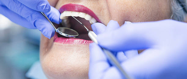 Best Emergency Dental Care for Broken or Chipped Teeth in Glendale, CA